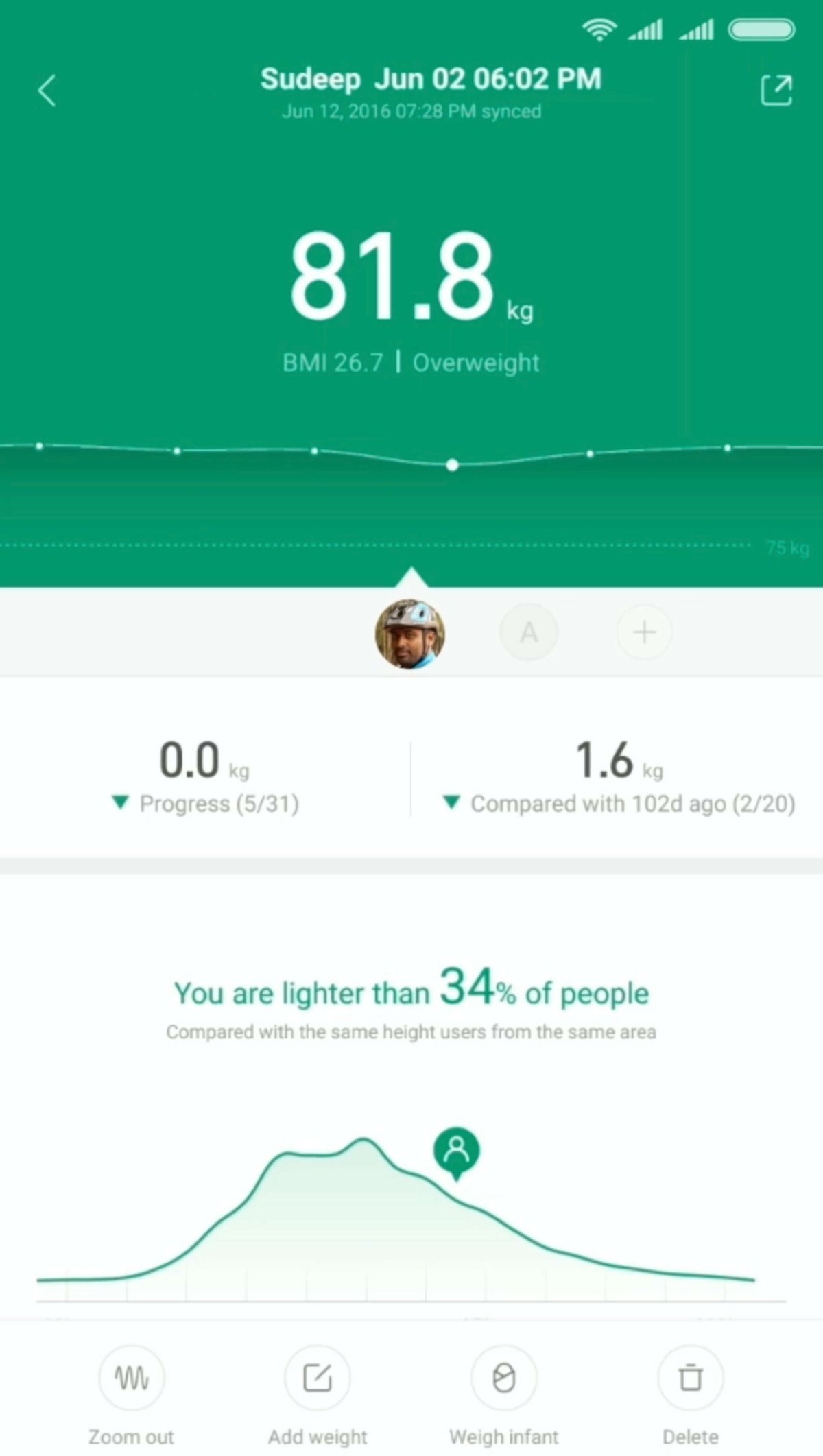 Recensione Xiaomi Mi Body Composition Scale 2: Valida o Solo fumo?